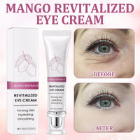 Katslyn 3 PCS Mango Revitalize Eye Cream Eyelift Serum, Mango Activating and Firming Eye Cream, Hyaluronic Acid Repair Essence for Dark Circles and Puffy