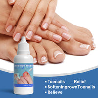 ASMAYSA Ingrown Toenail Correction Extra Strong - Ingrown Toenail Drop- Cuticle Care Oil for Ingrown Toenails - Trimming Toenail Softening Drop Ingrown Toenail Correction,20ml