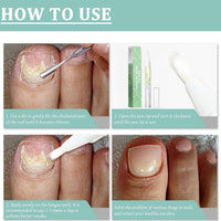 2pcs Radiant Nail Growth Oil,Cuticle Moisturizer & Nail Strengthener with Vitamin E Cuticle N/ail Oi/l,Radiant N/ail Growth O-il Pen,Cuti-cle Oi/l Pen for Nails,Nail-Oil Treatment for Damaged Na-ils