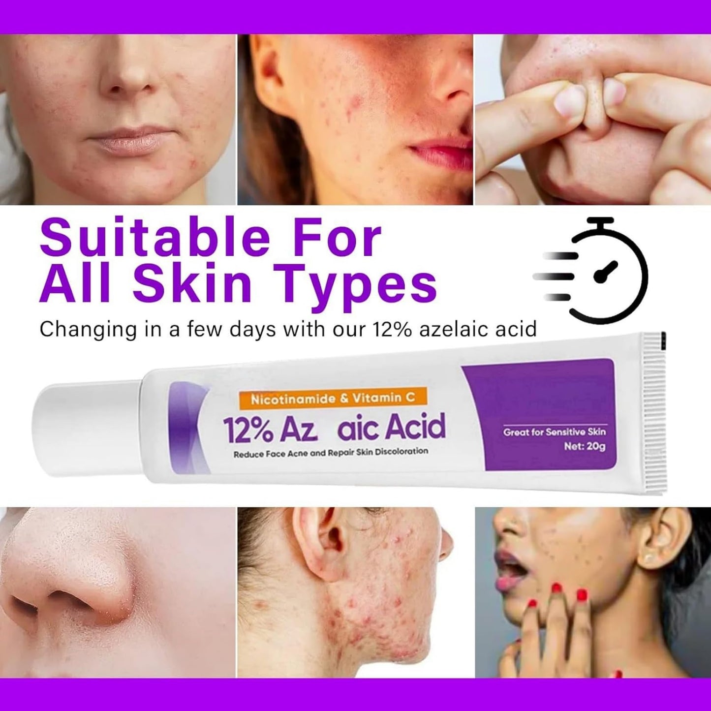 SingHao 2pcs Spot Cream,Acid 12% Facial Serum Cream,Azela-Ic Acid Face Cream,Night Cream Face Moisturiser,12% Ac/id Pimple Crea/m Spot Treatment,Azela-Ic Aci/d Serum for Face,Acne Treatment for Spo/t Prone