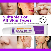 SingHao 2pcs Spot Cream,Acid 12% Facial Serum Cream,Azela-Ic Acid Face Cream,Night Cream Face Moisturiser,12% Ac/id Pimple Crea/m Spot Treatment,Azela-Ic Aci/d Serum for Face,Acne Treatment for Spo/t Prone