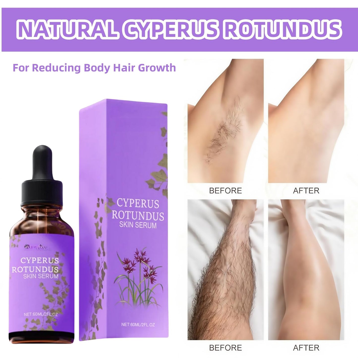 ShunJian Cyperus Rotundus Oil for Hair Removal,Organic Cyperus Rotundus Oil to Minimize Regrowth,Cyperus Rotundus Skin Serum,Ingrown Hair Treatment,Hair Growth Inhibitor,Daily Moisturizing & Soothing Care