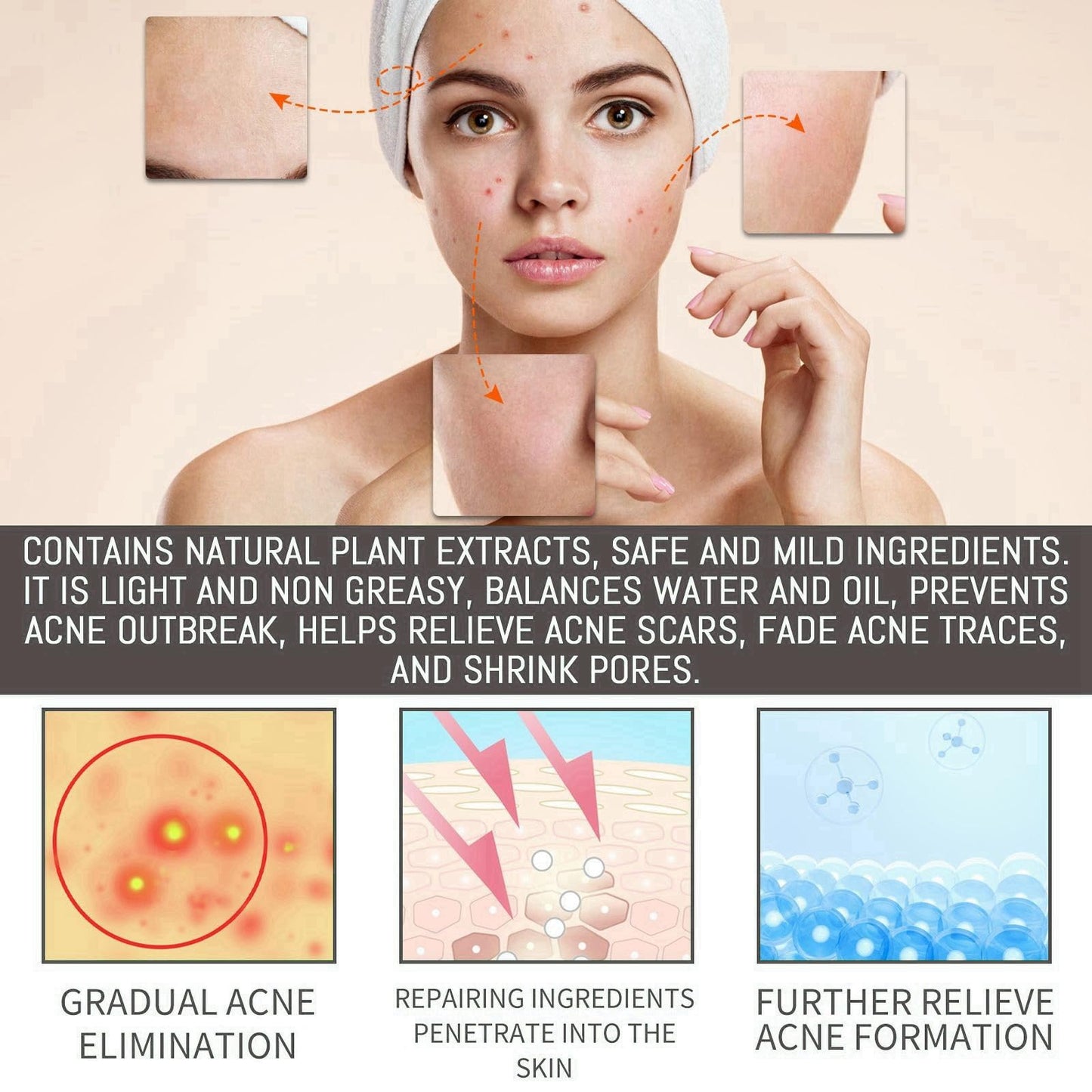 BigyQiu Azelaic Acid 12% Facial Serum Cream,Azelaic Acid Cream with Niacinamide Vitamin C,Brightening Face Skin Care Treatment for All Skin Types,Repair Dark Spots Skincare for Fresher and Smoother Skin