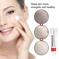 Whitening Freckle Cream,Dark Spot Remover for Face,Freckle Removal Cream,Acne Scar Removal Treatment Crea/m,Skin Lightening Cre/am for Dark Skin,Dark Spot Corrector Cr/eam,Spot C/ream for Women & Men