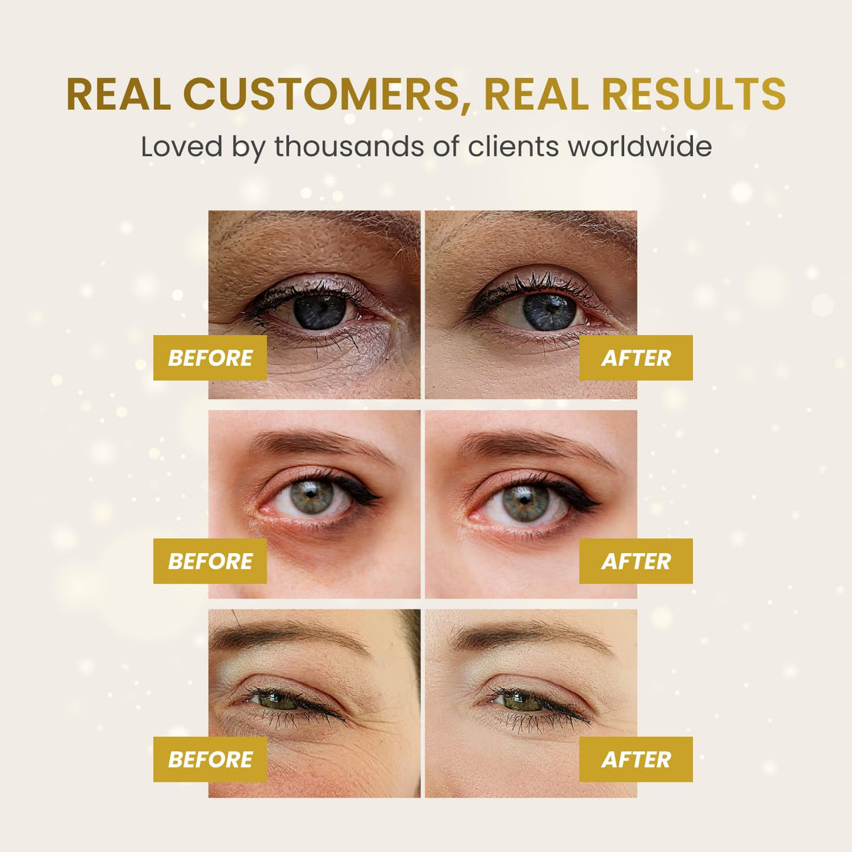 PLANTIFIQUE 24K Gold Under Eye Patches - Dermatologist Tested - 20 Pairs Collagen & Hyaluronic Acid Eye Masks for Dark Circles & Puffiness
