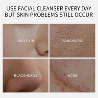 mercham 20 PCS Clay Mask, Deep Cleanse Mud Mask Set, Oil Control, Shrink Pores, Hydrating Clay Face Masks Gift, 100% Vegan Face Masks Skincare for All Skin Types 5g*20