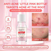 OUKEYA Spot Drying Lotion for Spots 2 x 10ml, Acne Care for Face with Salicylic Acid & Niacinamide, Oil Balancing, Pore Refining, for Acne-Prone and Oily Skin