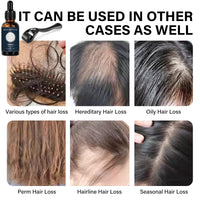 Ninnyi Beard Grooming Care Kit for Men, Beard Oil Roller for Growth