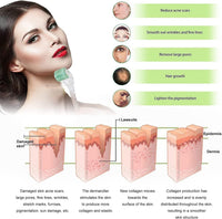Koi Beauty KOI BEAUTY Derma Roller 1mm - 200 REAL NEEDLE, Professional Microneedling Roller for Hair &Beard Growth at Home, Dermaroller for Face Body Scalp for Women Men, Micro Needling Roller Titanium