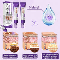 2 PCS Advanced Anti-Hyperpigmentation Cream, Pigmentation Removal Cream Face for Hyperpigmentation, Tightens Skin Suitable for All Skin Types