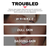 Turmeric Retinol Eye Cream Stick,Eye Cream Stick for Dark Circles and Puffy Eyes,Dark Circle Eye Cream Stick,Anti Wrinkle Eye Cream,Firming Eye Cream Stick,Retinol Eye Cream Stick to Reduce Fine Lines