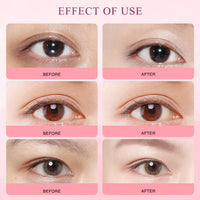 Ninnyi Mango Revitalize Eye Cream, Hyaluronic Acid Repair Cream, Mango Activating and Firming Eye Cream, Removes Eye Bags & Dark Circles