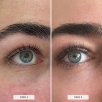 HAIR BURST Eyelash & Brow Growth Serum - Hormone Free, Fuller Lashes 9ml