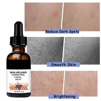 Dark Spots Correcting Facial Serum,2PCS Brightening Facial Serum,Rapid Dark Spot Correcting Serum,Improve Dry Skin & Smooth Skin,Brightening Serum,Dark Spot Remover Serum For Melanin Correcting