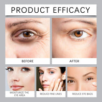 2Pcs Lutein Eye Essence Oil,Lutein Rollerball E/ssence for E/yes,VC Lutein Anti-Wrinkle Essence Oil,Ey/e Cream for Wrinkles,Anti Aging Serum for E/ye,Moisturizing Skin for Eye Bags,Eyebag Remover