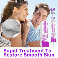 Acid 12% Facial Serum,Anti Acne Cream Face Serum,Aze/laic Aci/d for Anti Acne,A/cid Face Spot Treatment,Night Cr/eam Face Moisturiser,Skin Care Gel, A cne C/ream Skin Care,Acid Serum