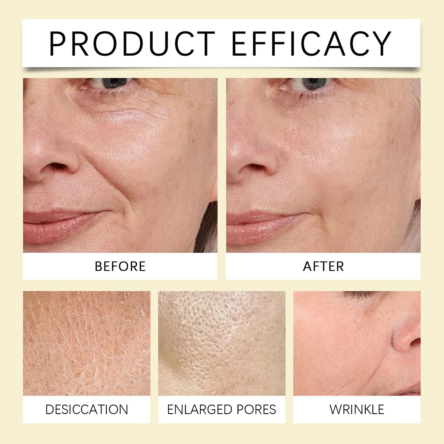 Soneat Bio Collagen Face Mask,Anti Wrinkle Mask,Firm Skin Deep Hydrating Mask,Bio Collagen Face Mask Overnight,Hydrating Hydrogel Mask,Small Molecule Penetration, Elasticity Improvement (Whtie1)