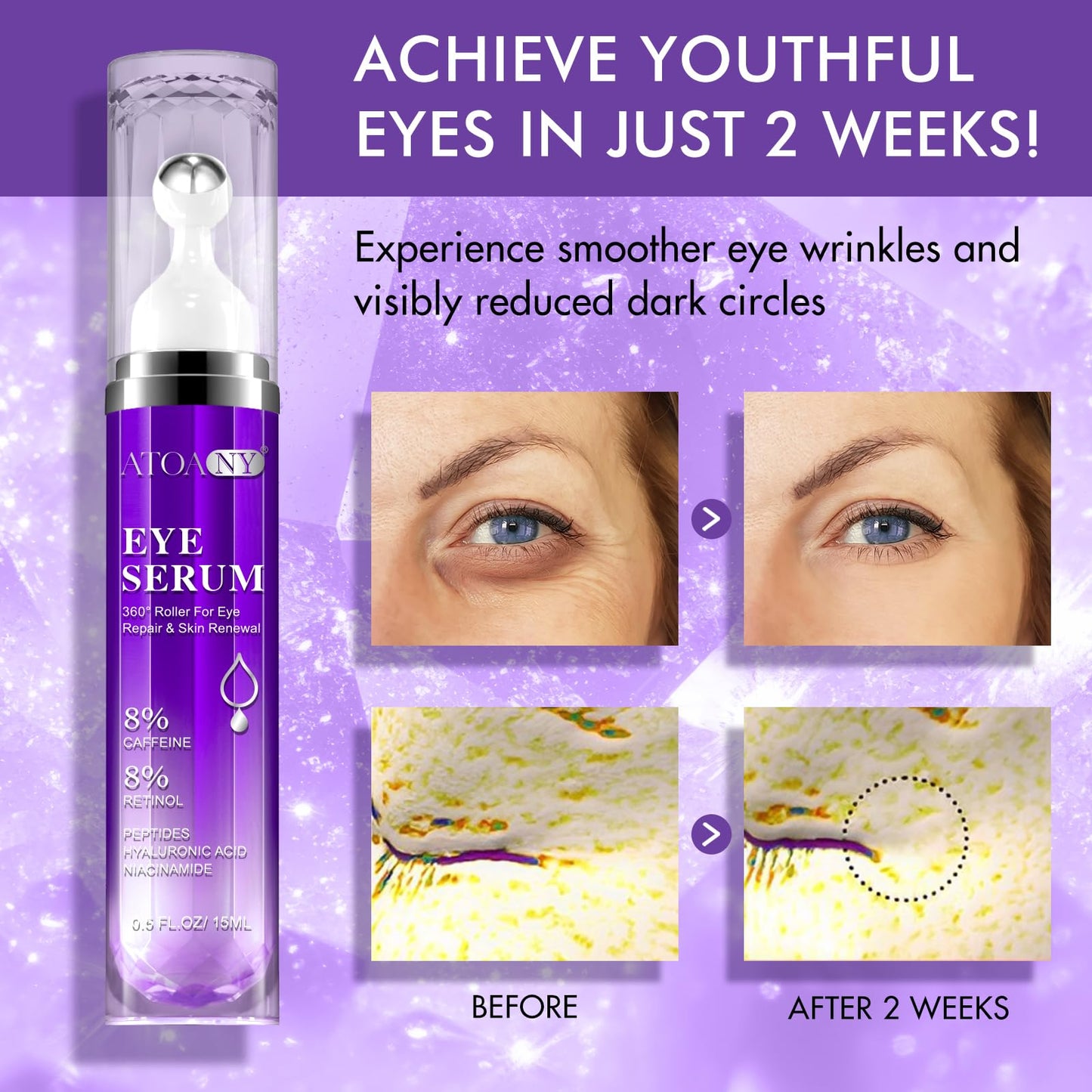 GMOLARSUSCO Eye Serum with 8% Caffeine & 8% Retinol Hyaluronic Acid Niacinamide for Anti Aging, Puffy Eye Bags Fine Lines Dark Circles Wrinkles, Under Eye Cream with 360° Eye Roller Massage Ball 15ML