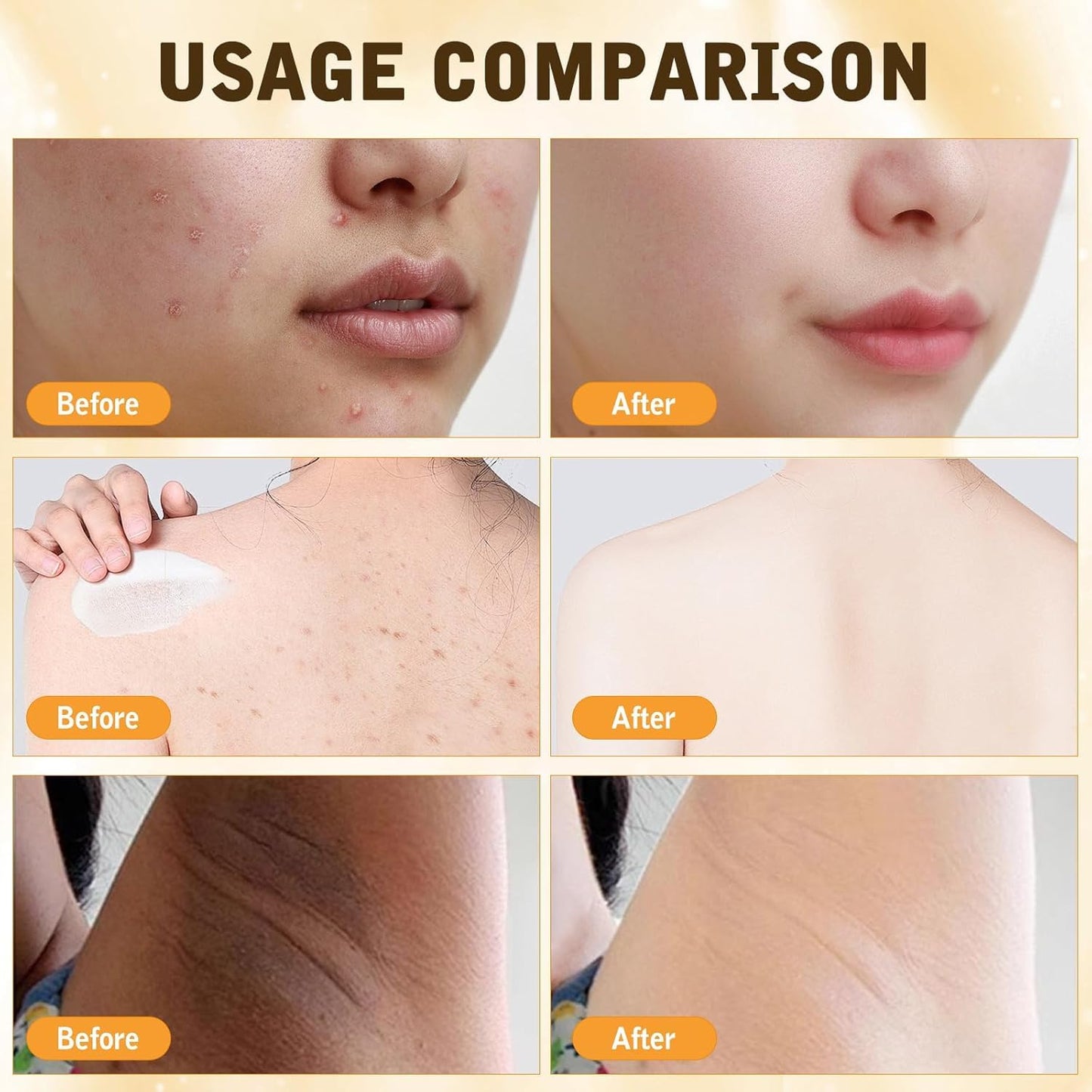 OXGPAL Bee Venom Skin Restoration Cream, Professional Bee venom Skin Treatment Cream, Bee Venom Comprehensive Creams, Firming Moisturizing & Repair Reduces Blemishes for All Skin Type (2 Bottle*60ML)