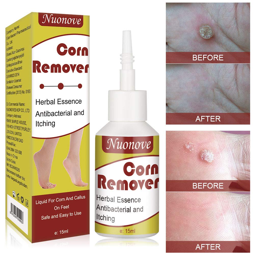 Corn Remover Wart Remover Corn Removal Corn Remover for Feet, Callus Remover, Cuticle Remover, Corn Remover Liquid to against Corn & Wart,15ml