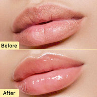 KISSIO Honey Lip Butter Set,Lip Balm with 1000 ppm Propolis Extract,Ceramide AP and Phytosphingosine,Long-lasting Moisture and Nourishe Lips,Lip Lines Care