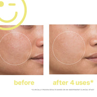 KATE SOMERVILLE MEGA-C™ 30% Vitamin C Brightening Facial