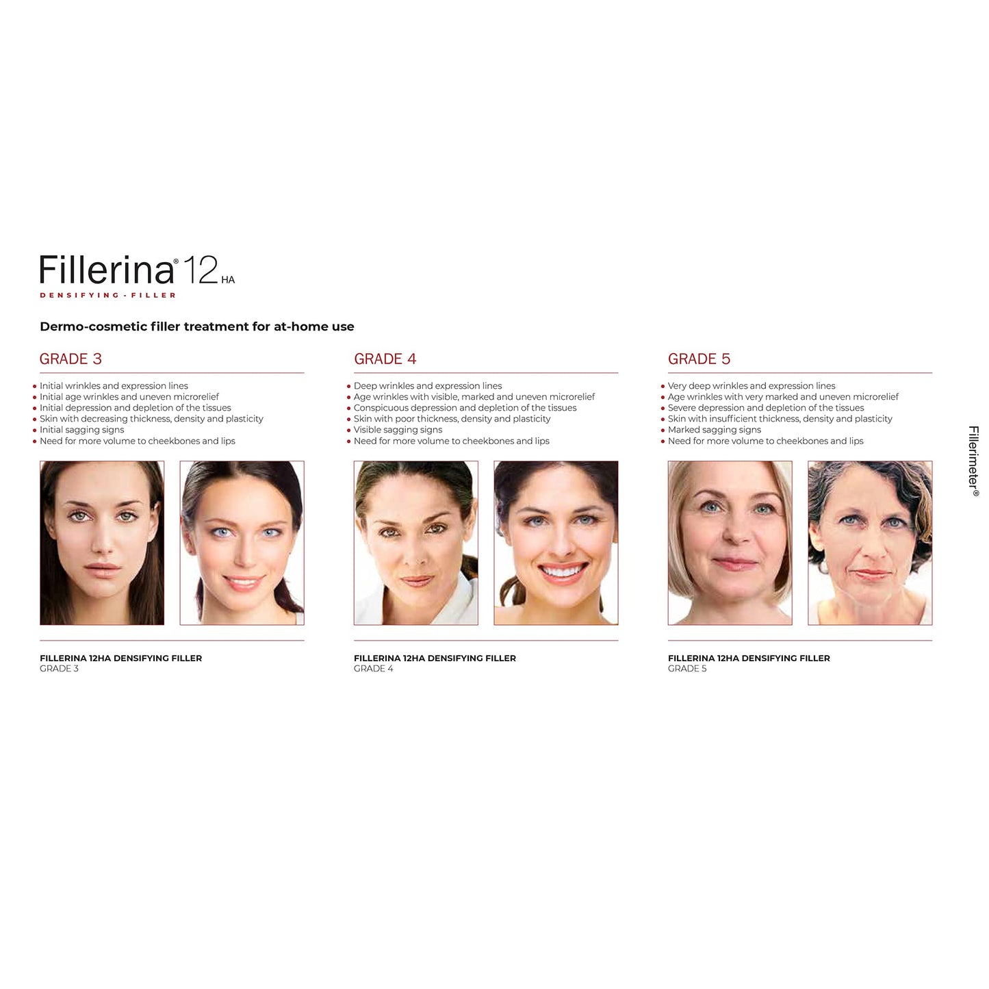 Fillerina 12 Densifying-Filler - Eyes & Eyelids Grade 3