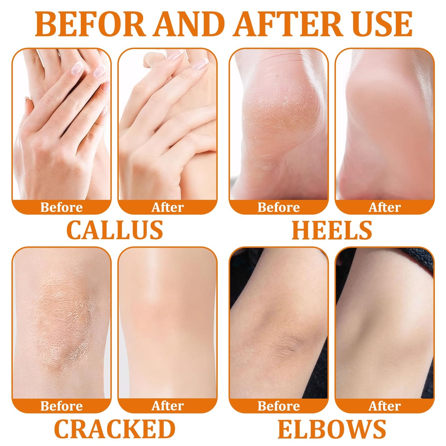 GMHLLES 3 Bottles Honey Foot Cream, Heel Balm for Cracked, Heel Cream for Deep Cracked Skin, Strong Moisturizing and Repairing, for Daily Skin Care for the Whole Body (40g*3)