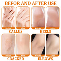 GMHLLES 3 Bottles Honey Foot Cream, Heel Balm for Cracked, Heel Cream for Deep Cracked Skin, Strong Moisturizing and Repairing, for Daily Skin Care for the Whole Body (40g*3)