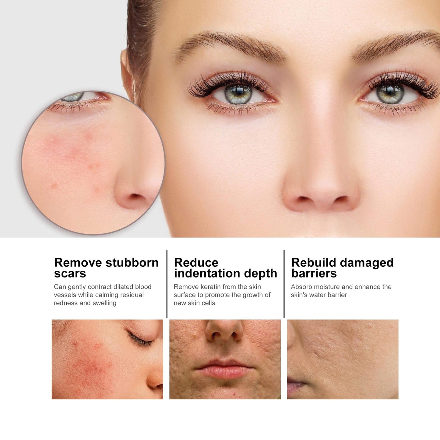 OuXing Dark Spot Remover for Face and Body,Dark Spot Remover Serum,Dark Spot Corrector,Sun S/pot and Age S/pot Remover,Freckle Removel Cream,Hydrating Serum,Brightening Serum,Skin Serum,Facial Serum