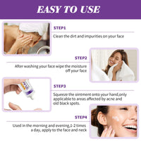 Azelaic Acid Cream,Azelaic Acid Face Cream,Azelaic Acid Serum,Azelaic Acid 12% Facial Serum,Facial Serum Cream,Niacinamide & Vitamin C Face Cream,For All Skin Types (20g)