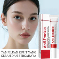 Whitening Freckle Cream,Moisturizing Removes Facial Dark Spots,Dark Spot Remover,Spot Removal Treatment Cream,Sp/ot Off Freck/le Whitening Crea/m,Anti wrinkle Moisturizing Fre/ckle Remover Cre/am