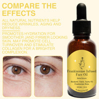 Leogony 2Pcs Frankincense Oil for Skin, Organic Moisturizing Frankincense Resin Cold Pressing Essence, Smooths Fine Lines and Wrinkles