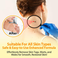 jinyue Bee Cream, Bee Care Cream,Bee Venom Tag Remover，Bee Venom Moles and Warts Removal Cream, Bee Venom Cream Bee Venom Repair Cream for All Parts of The Body 100g