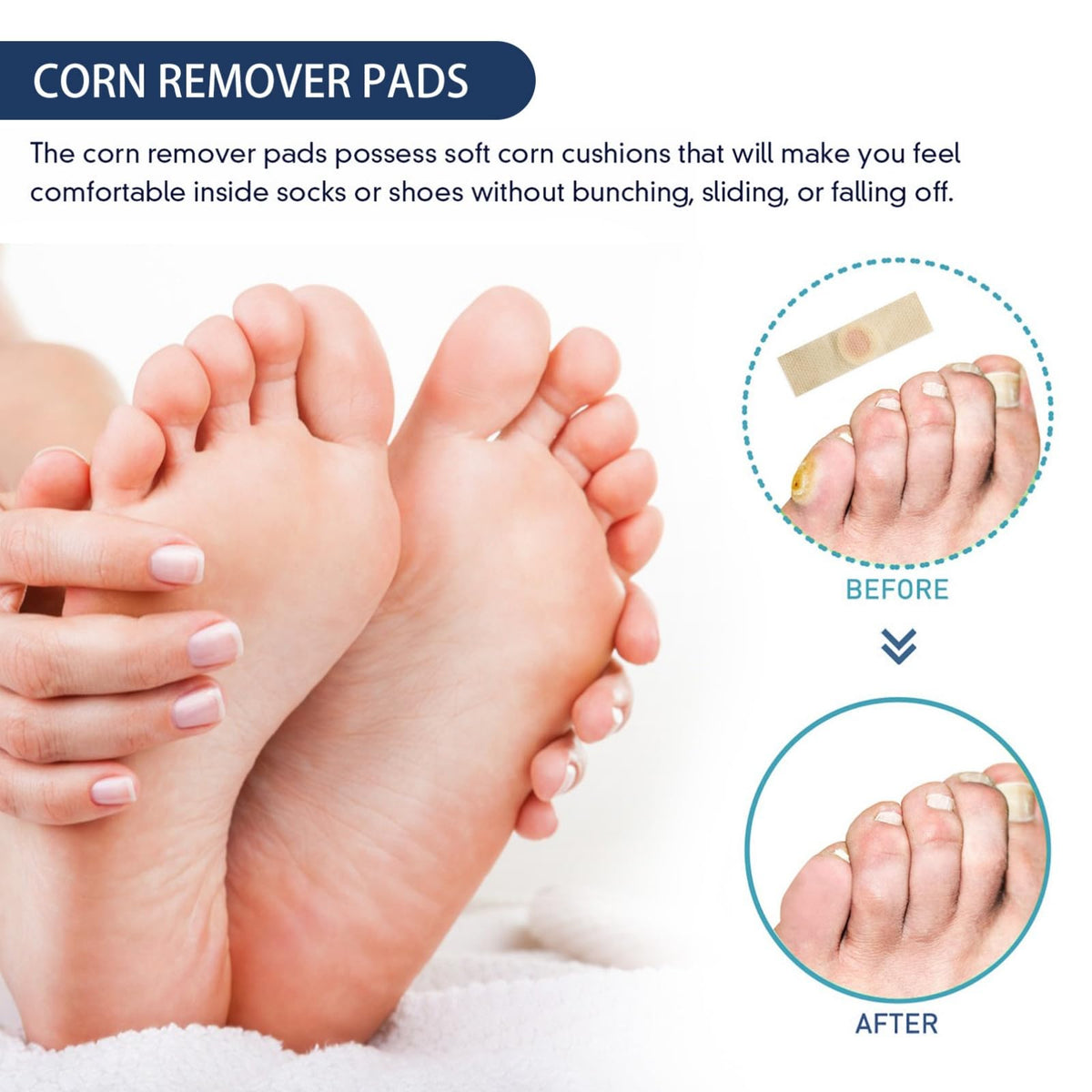 Ruojiar 24Pcs Verruca Treatment Corn Plasters,Wart Remover,Corn Remover for Feet and Hand,Gentle and Safe Verruca Plasters,Wart Removal Patches,Foot Care for Women and Men,Pain Relief,Gentle and Skin-friendly