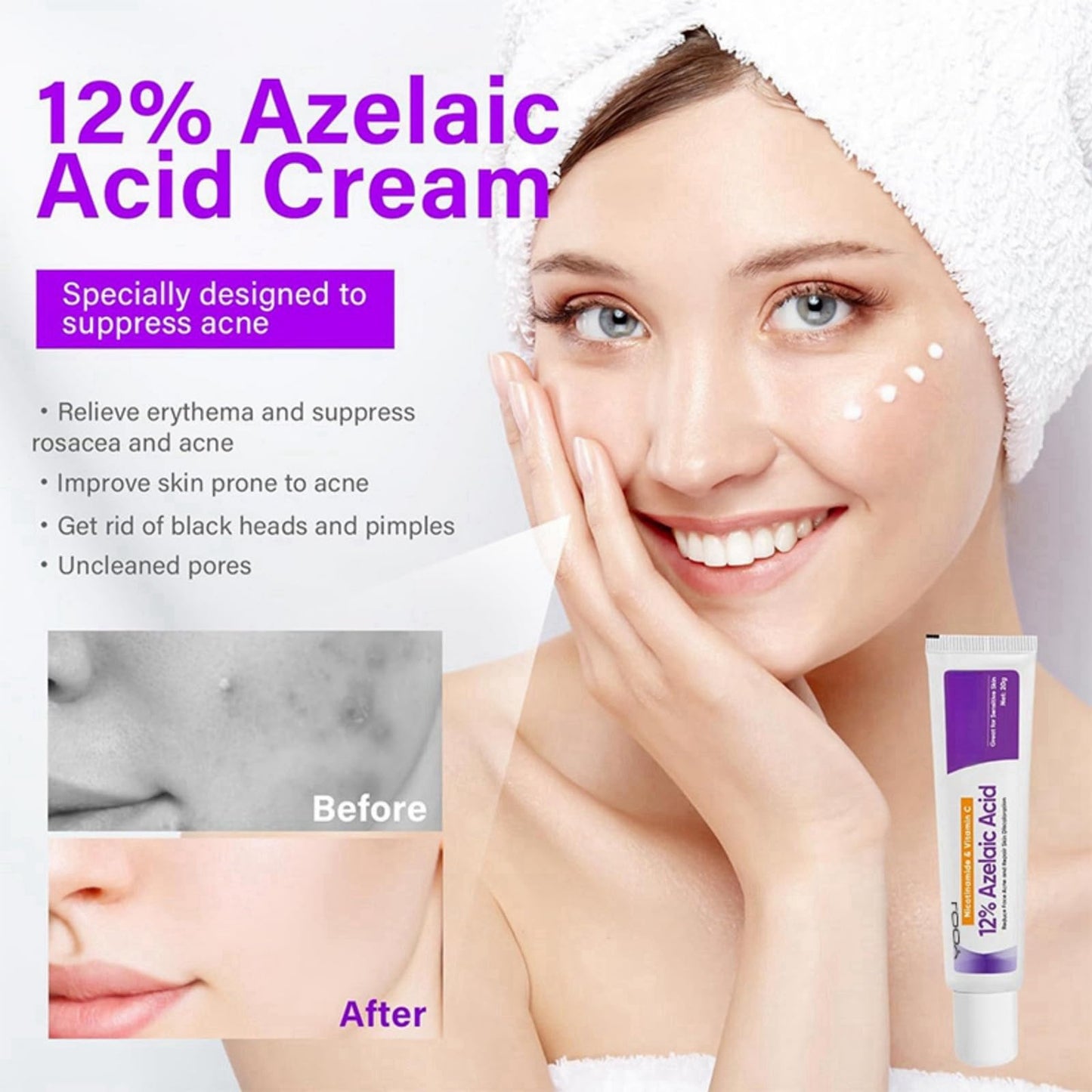 BigyQiu Azelaic Acid 12% Facial Serum Cream,Azelaic Acid Cream with Niacinamide Vitamin C,Brightening Face Skin Care Treatment for All Skin Types,Repair Dark Spots Skincare for Fresher and Smoother Skin