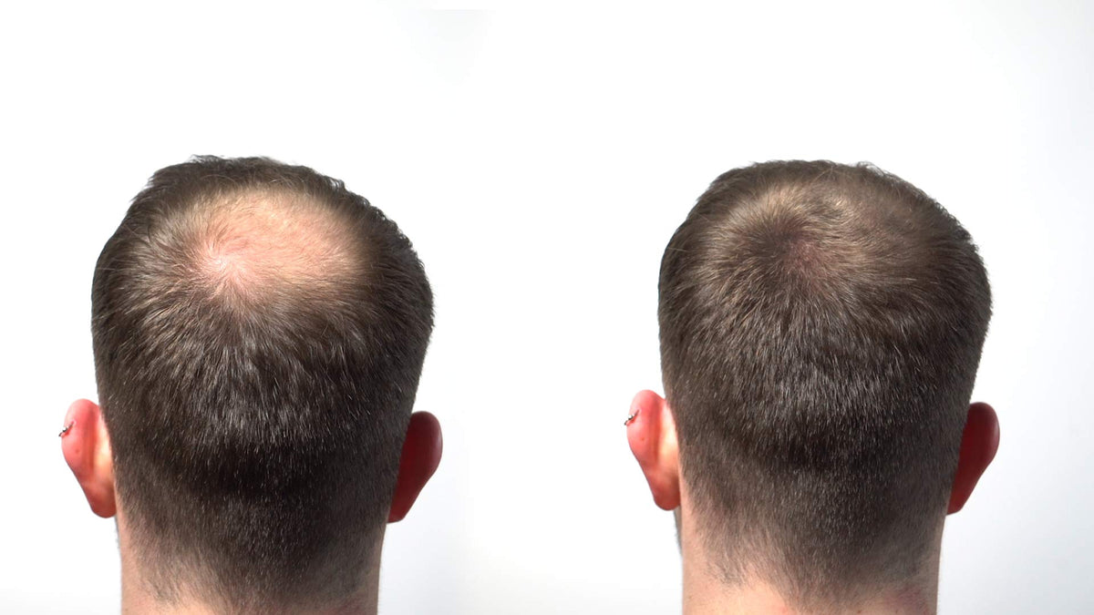 HairLab 100% Organic Hair-Thickening Keratin Fibres for Concealing Hair Loss and Thinning Hair - 30g Grey