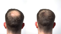 HairLab 100% Organic Hair-Thickening Keratin Fibres for Concealing Hair Loss and Thinning Hair - 30g Grey