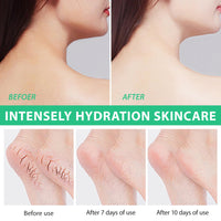 Generic 40% Urea Cream Plus 2% Salicylic Acid - Hyaluronic Acid,Tea Tree,and Aloe Vera Foot Cream Deep Moisturizes Urea Cream for Foot and Hand Maximum Strength - Callus Remover for Cracked Feet, Heels