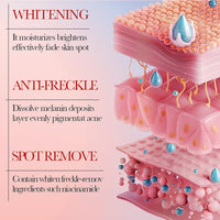 Muiefe 2Pcs Freckle Removal Cream, Dark Spot Remover for Face and Body, Dark Spot Corrector Cream with Vitamin C, E & Niacinamide, Fade Spots Blemishes, Reduces Hyperpigmentation, Improves Skin Tone