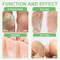 Foot Peel Mask for Hard Skin, 4 Pairs Foot Exfoliating Socks, Moisturizing Foot Care for Callus Remover, Cracked Heel, Dead & Dry Skin - Baby Soft Smooth Touch Feet(Aloe Vera)