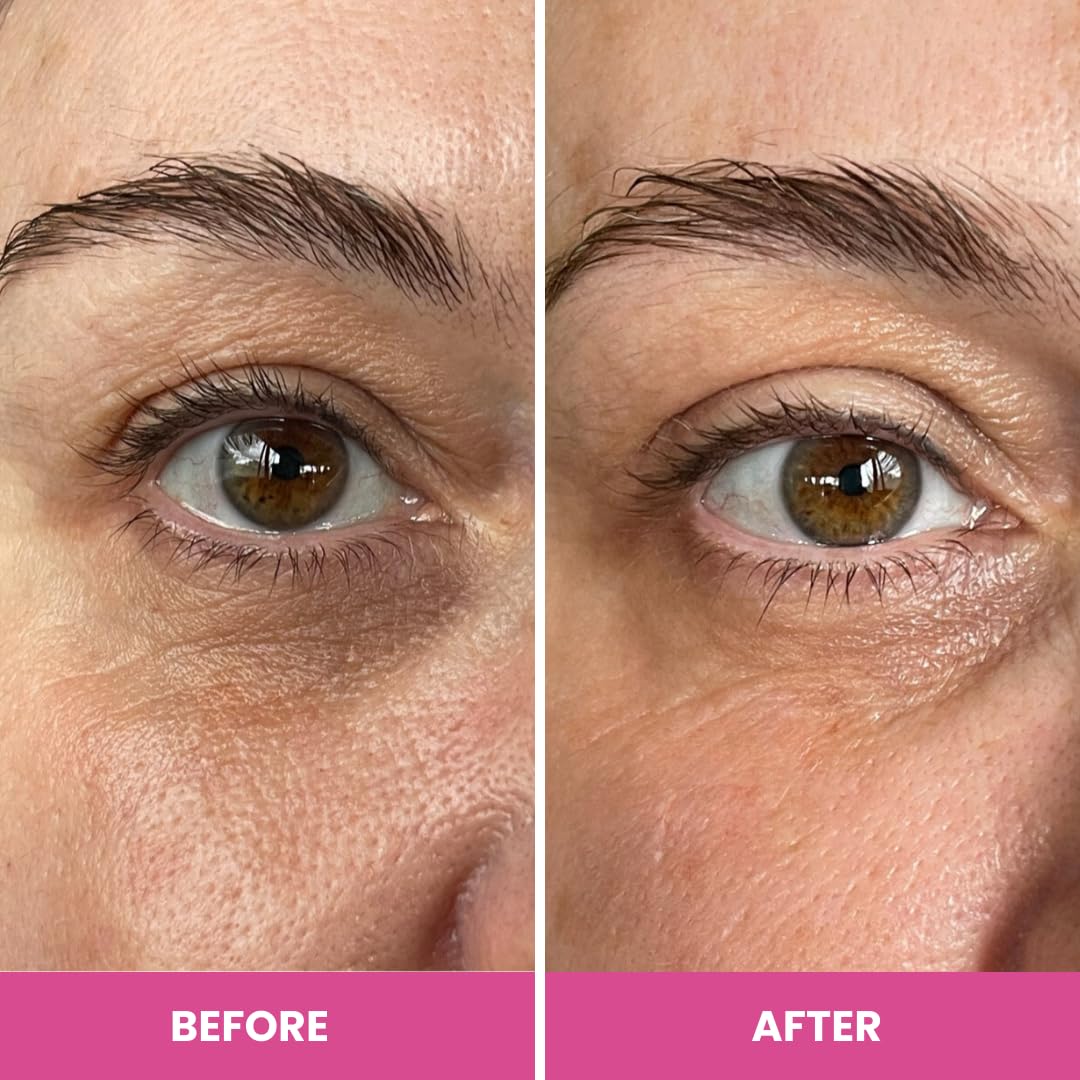 PRIME PROMETICS Prime Prometics PrimeEyes Hydrate Under Eye Cream for Mature Women – Hydrating Eye Cream for Dark Circles and Wrinkle Repair – Soft, Glowing & Healthy Under Eyes