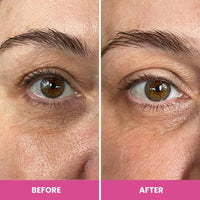 PRIME PROMETICS Prime Prometics PrimeEyes Hydrate Under Eye Cream for Mature Women – Hydrating Eye Cream for Dark Circles and Wrinkle Repair – Soft, Glowing & Healthy Under Eyes