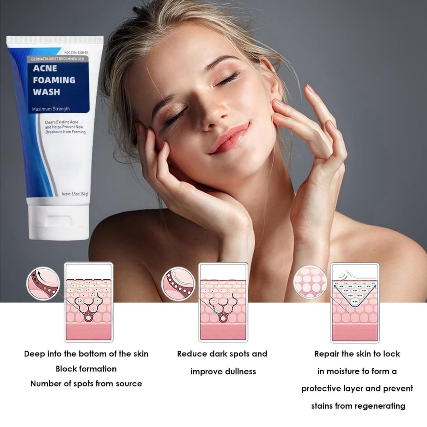 Acne Foaming Wash,Mild Daily Facial Cleanser for Deep Pore Cleansing,Acne Foa/m Wash,Gentle Daily Cleans/ing Foam,Clea/nsing Fo/am for Women,Facial Wash Women to Soothe Redness,Exfoliating Face Wash