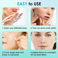 Home Holic 264 Pimple Patches Spot Patches Absorbing Cover Invisible Blemish Spot Skin Treatment Facial Fast Acting Skincare Acne Patch For Day and Night Use, Transparent