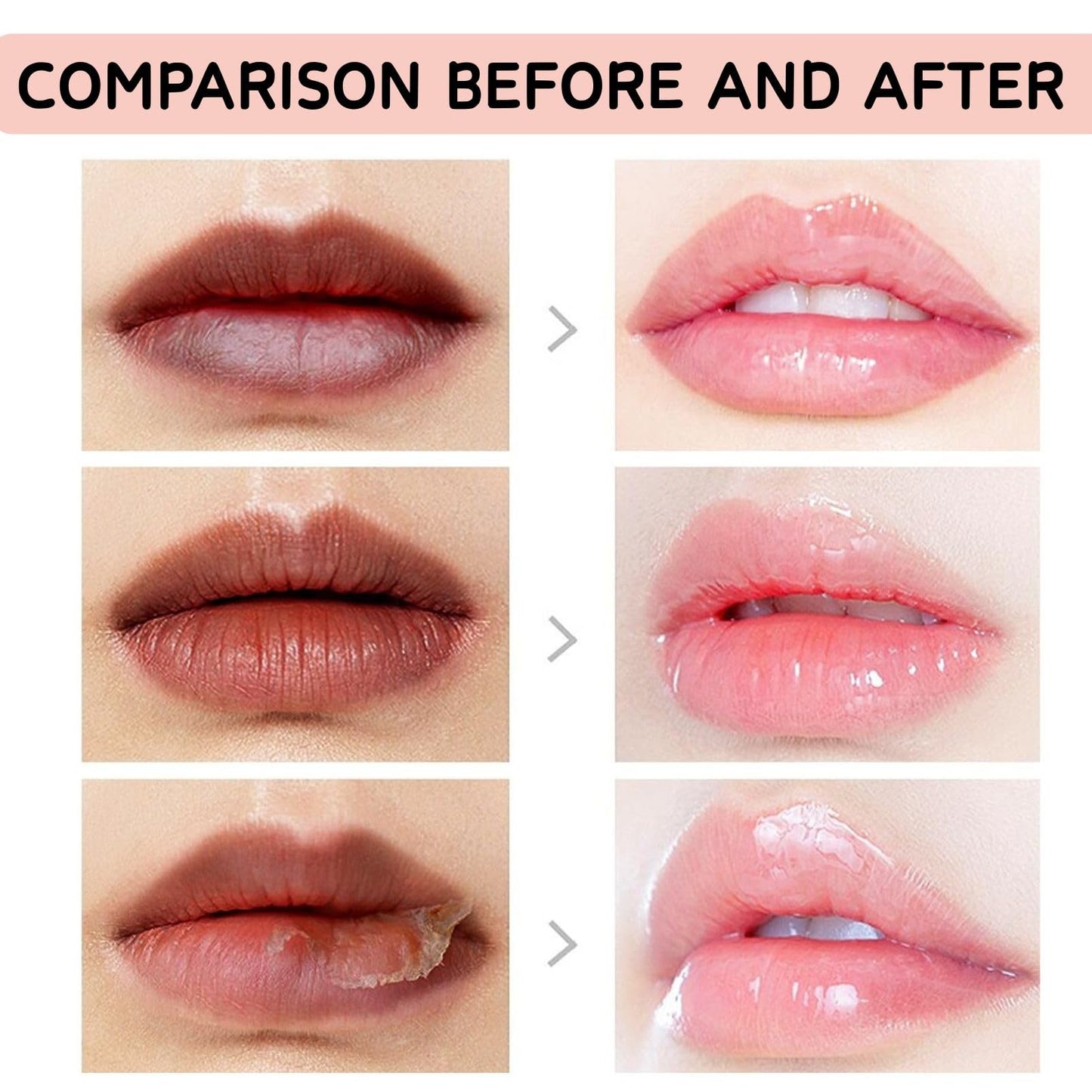 SHEBEEDO Lip Lightening Balm for Dark Lips,Brightening Balm for Smokers & Non-Smokers,Fade-Lip-Discoloration,Advanced Lightening Formula Visible Results Deep Moisturizing Highlighter(2Pcs)