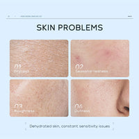 TBeautfave Hydrating Skin Care Sets & Kits, Hyaluronic Acid Skincare Sets, Pamper Sets for Women Gifts, Girls Pamper Set, Facial Kit with Moisturizer, Sreum, Cleanser and Toner set, Travel Kit with Wash Bag