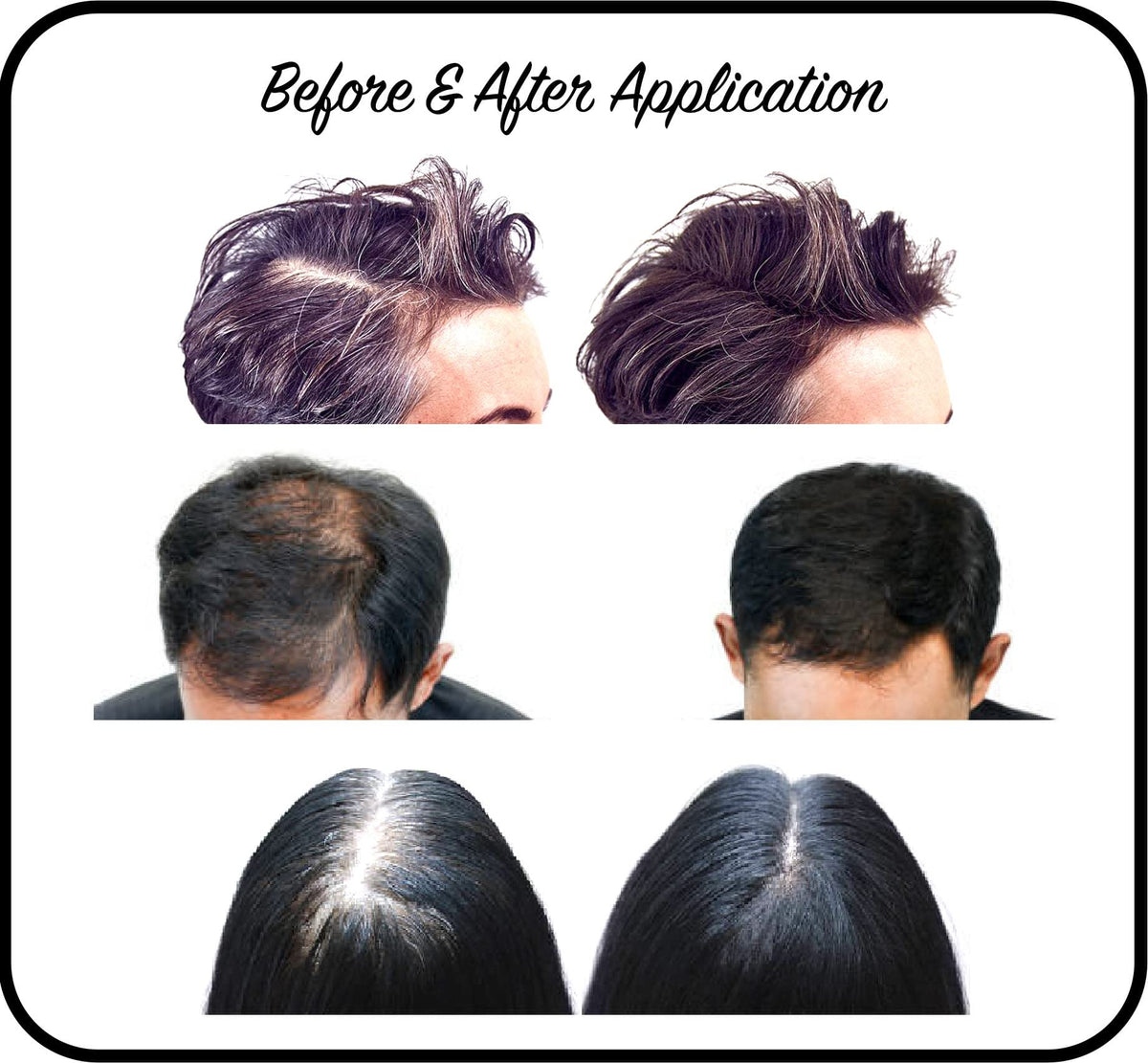 THICKIFY Hair Fibres for Thinning Hair Undetectable & Natural - 28g Bottle - Completely Conceals Hair Loss Instantly - Hair Thickener & Topper for Fine Hair for Women & Men (Grey)