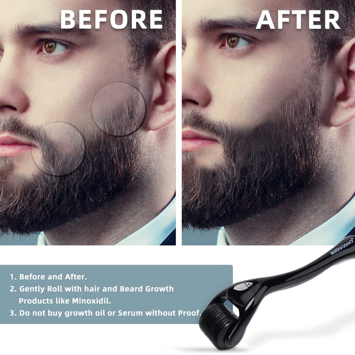 AUDUODUO Derma Roller 1.5mm SILVER Needles, ONLY for Professional Users, 540 Microneedle roller for Beard and Hair Growth, Anti-Aging Stretch Marks Scars
