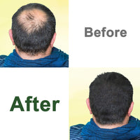 Castor Oil,2 Packs w/Free Lash&Brow Brushes&E-Book,100% Pure Hair Oil for Eyebrow Lash Eyelash Beard Growth Serum Dry Hair Skin Care Essential Oils,Gifts for Women Men Mum Wife Her